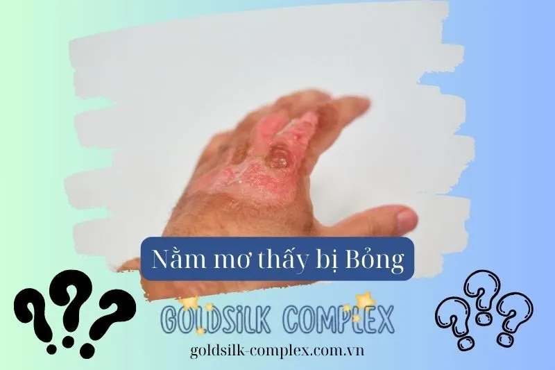 Giải Mã Ý Nghĩa Giấc Mơ Thấy Bị Bỏng Có Điềm Báo Gì